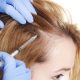 Hair Regrowth Treatment in Raipur. 3 GFC DIGITAL 1