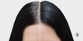 Grey hair