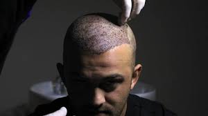 HTP IMAGE