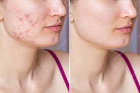 SKIN DIGITAL 1