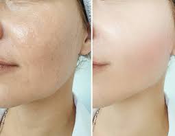 skin treatment digital 1
