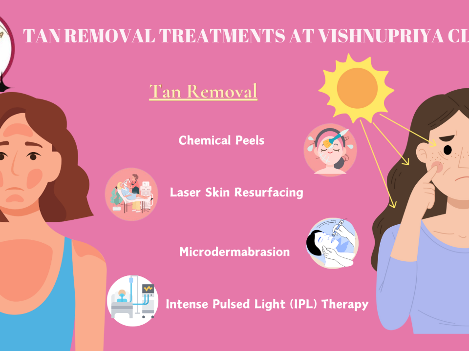 Tan Removal