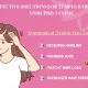 Temple Hair Loss