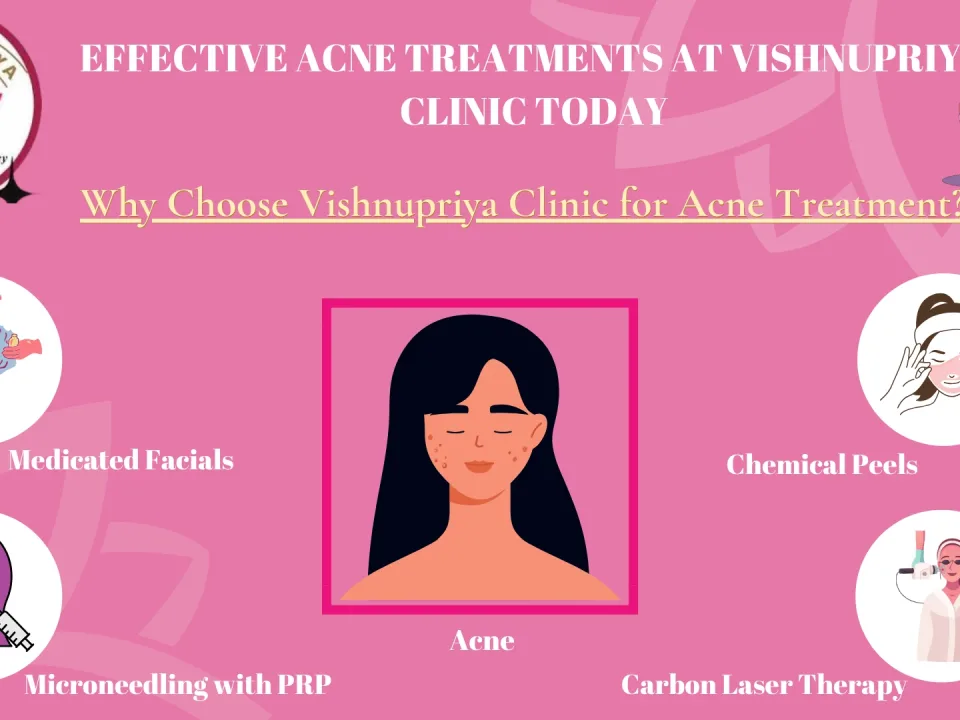 Acne Treatments